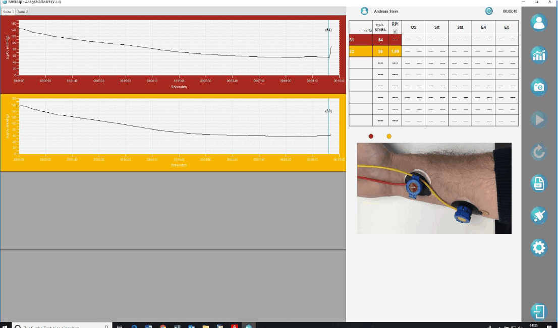 tcpo2 Messung Auswertung 1