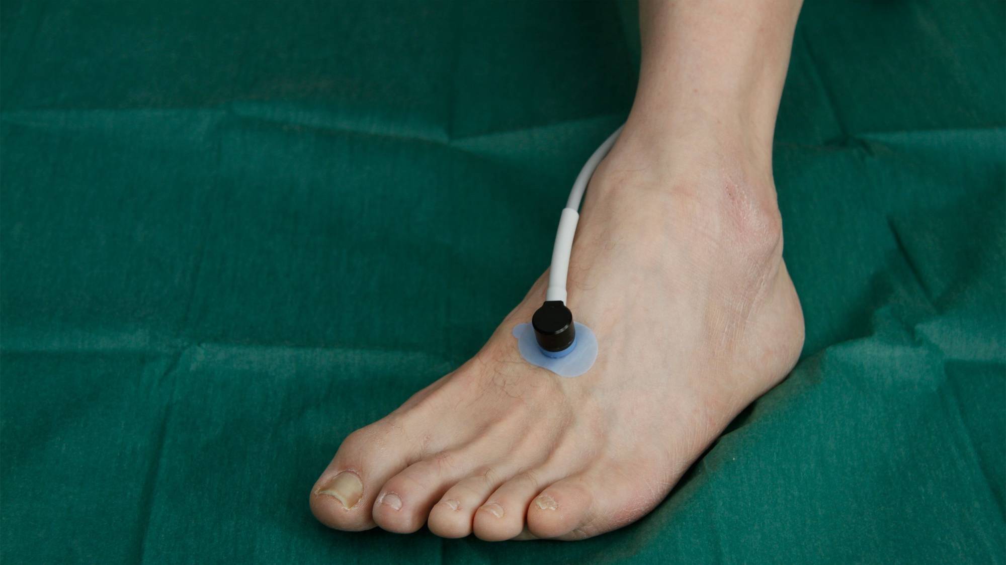 tcpo2 Messpunkt Vorfuss