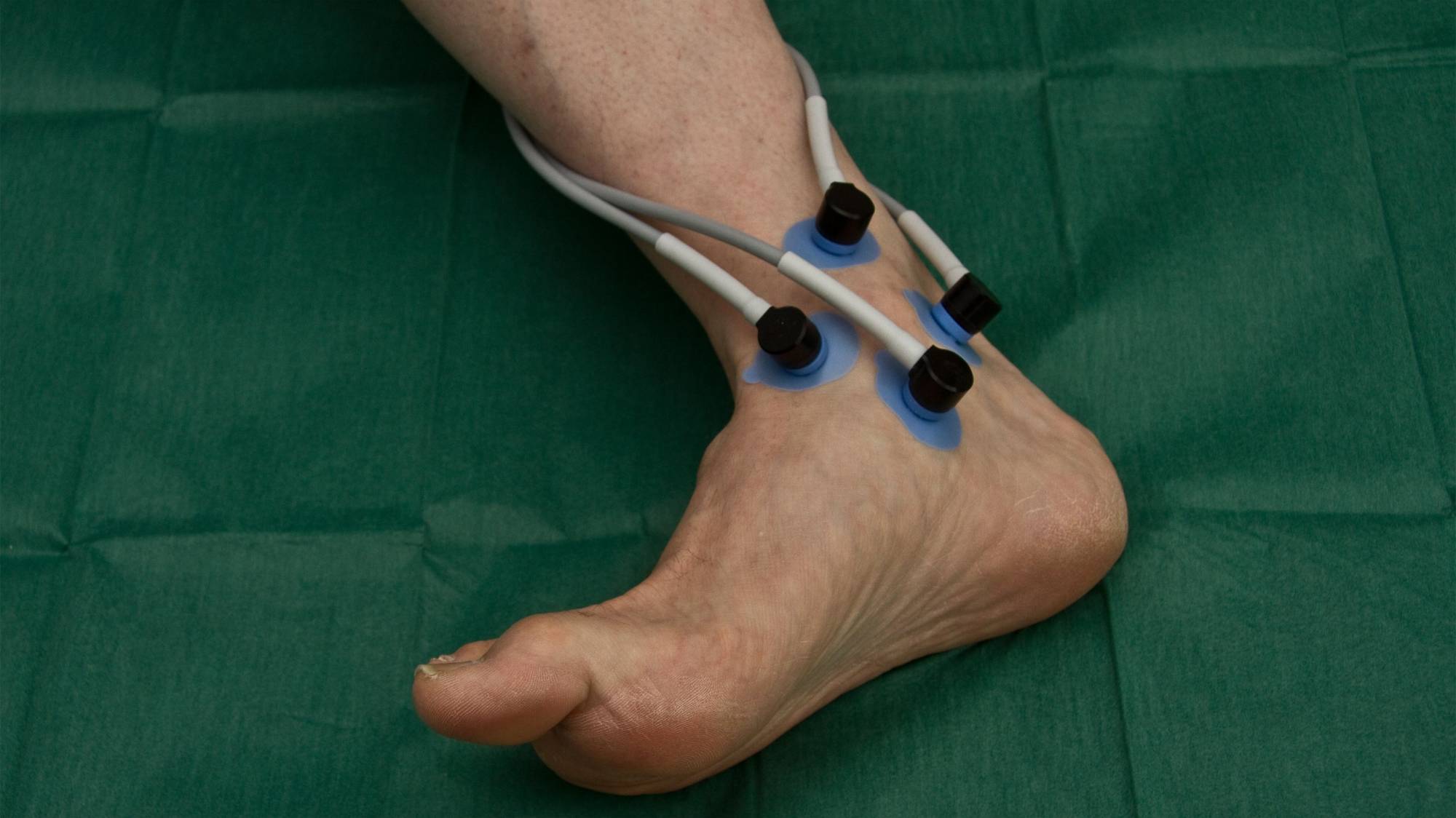 tcpo2 Messung Knöchel Mapping