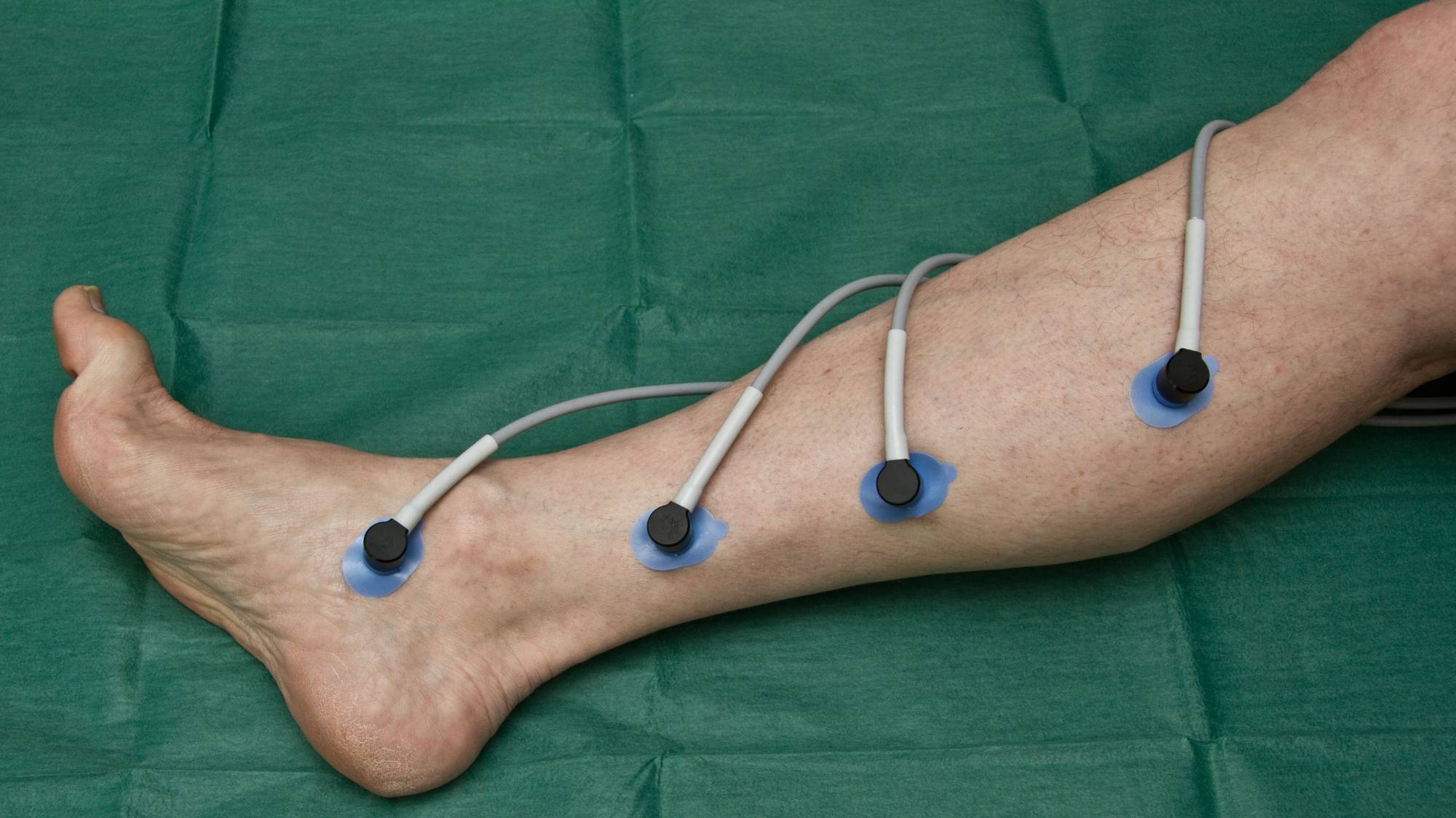 tcpo2 Messpunkte Bein