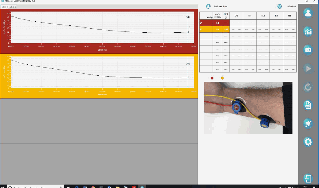 tcpO2-Auswertungssoftware: Eigene Bilder