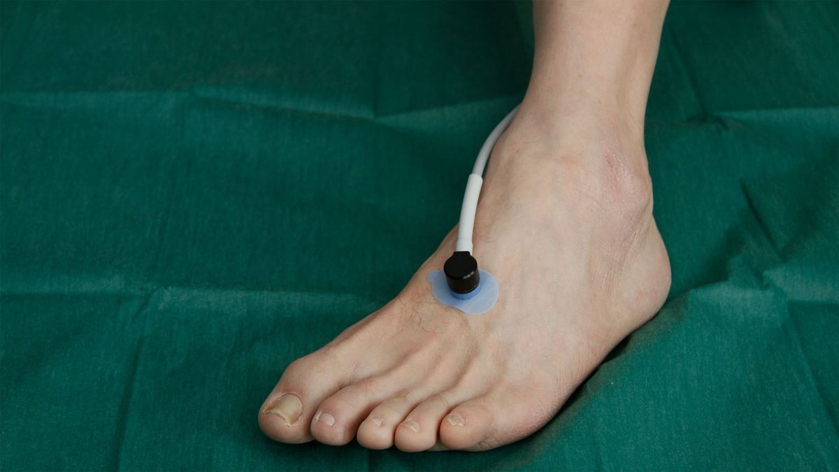 tcpO2-Sonde am Vorfuß während der Messung